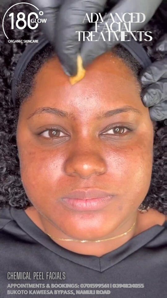 Instagram post from 180degrees.glow.skin. This post is in position 10.